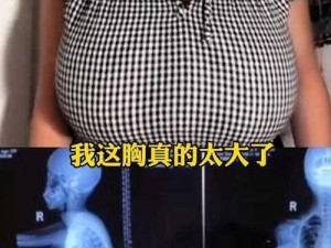 双乳太丰满，穿什么衣服都不好看，该怎么办？