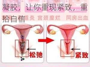 石原爱露女性私密处紧致凝胶，让你重现紧致，重拾自信