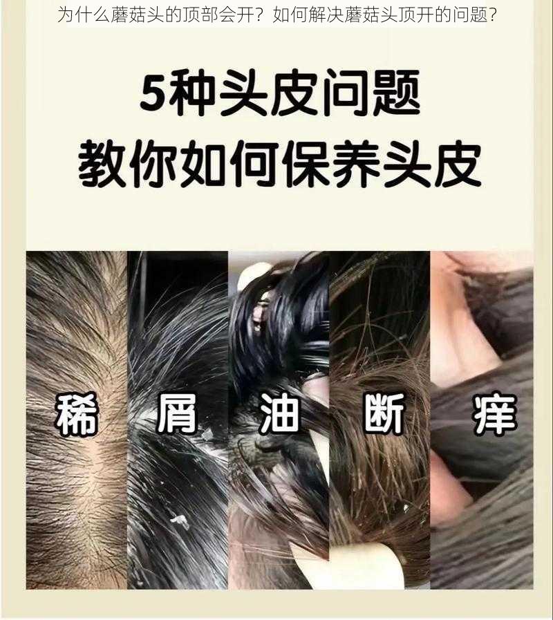 为什么蘑菇头的顶部会开？如何解决蘑菇头顶开的问题？